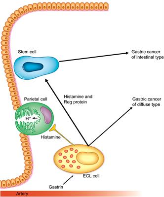 The central role of gastrin in gastric cancer